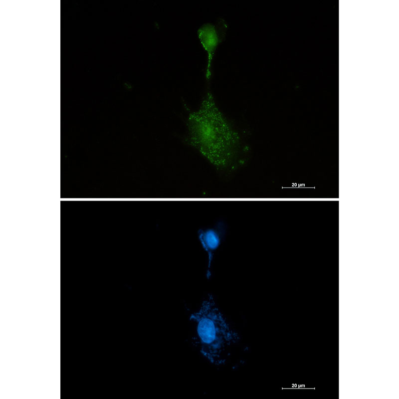 RSK3 Rabbit mAb