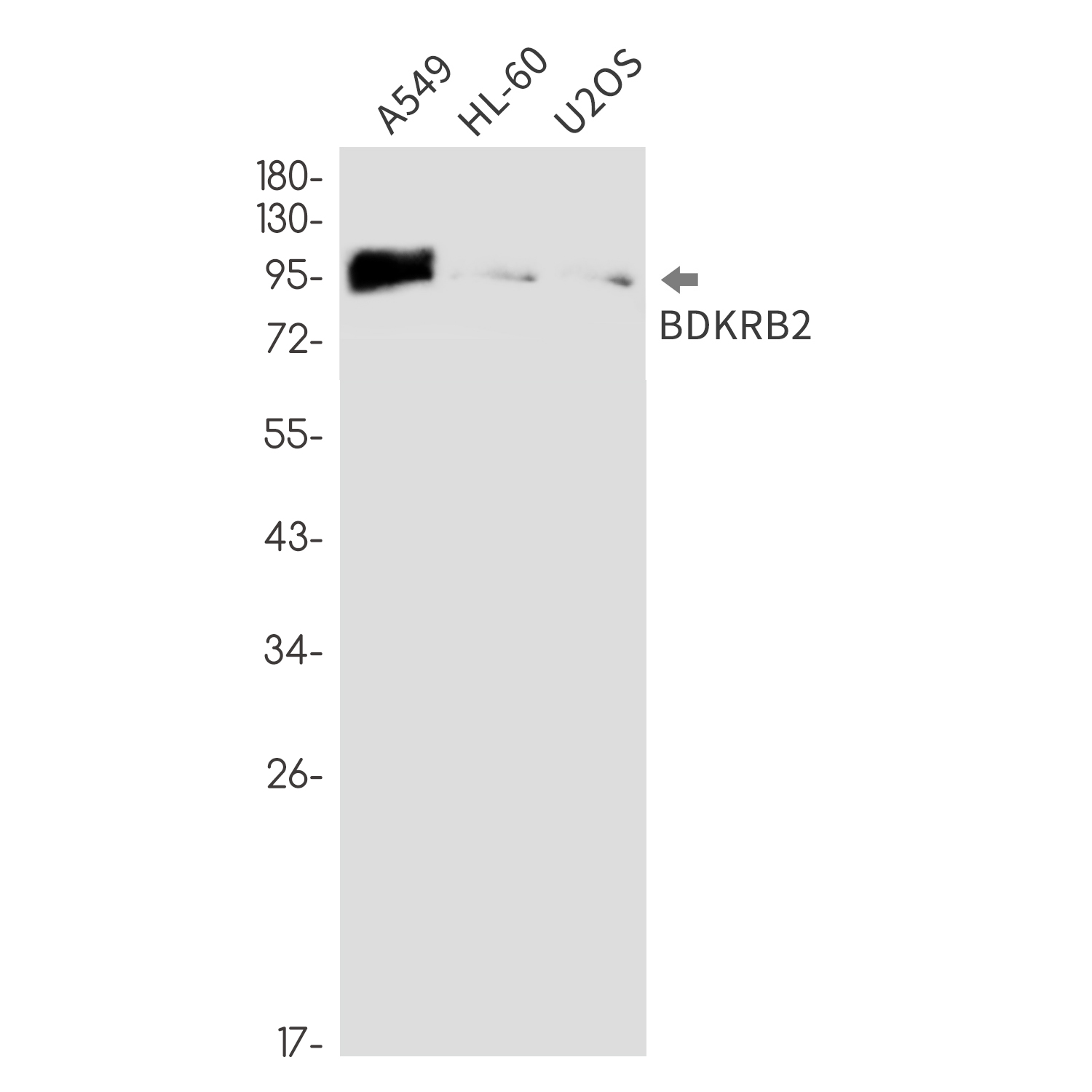 BDKRB2 Rabbit mAb