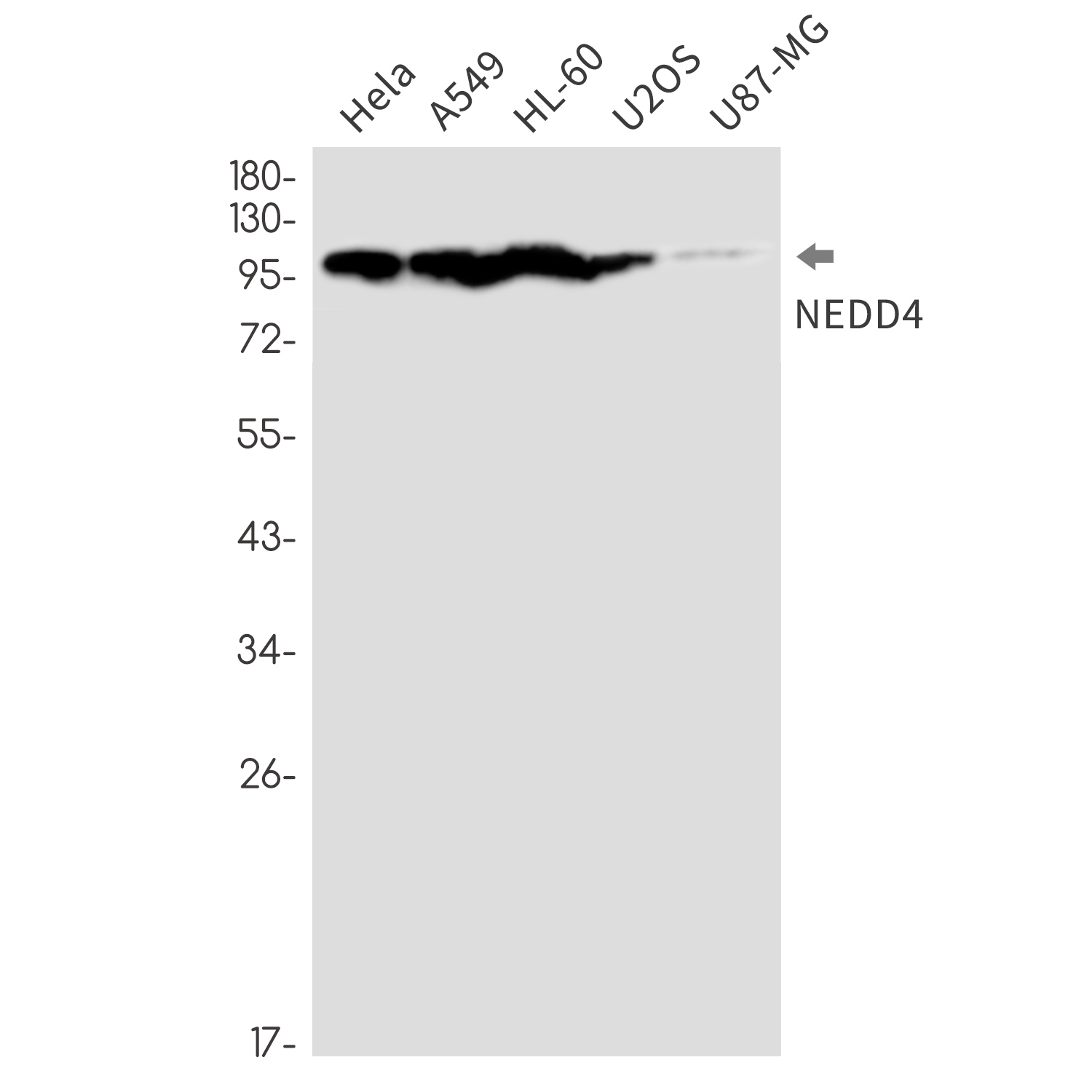 NEDD4 Rabbit mAb