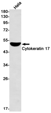 Cytokeratin 17 Rabbit mAb