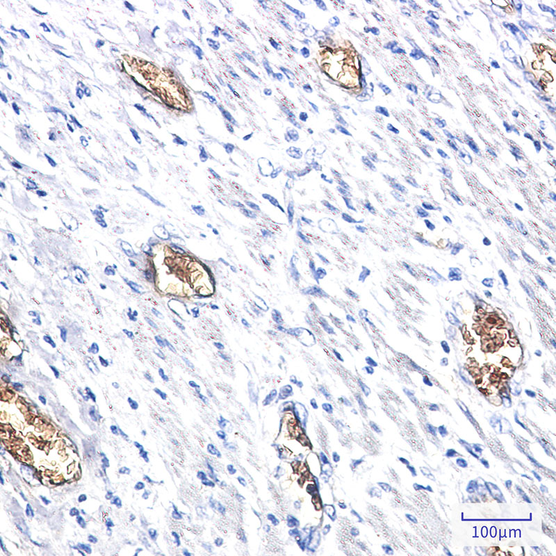 PACSIN3 Rabbit mAb