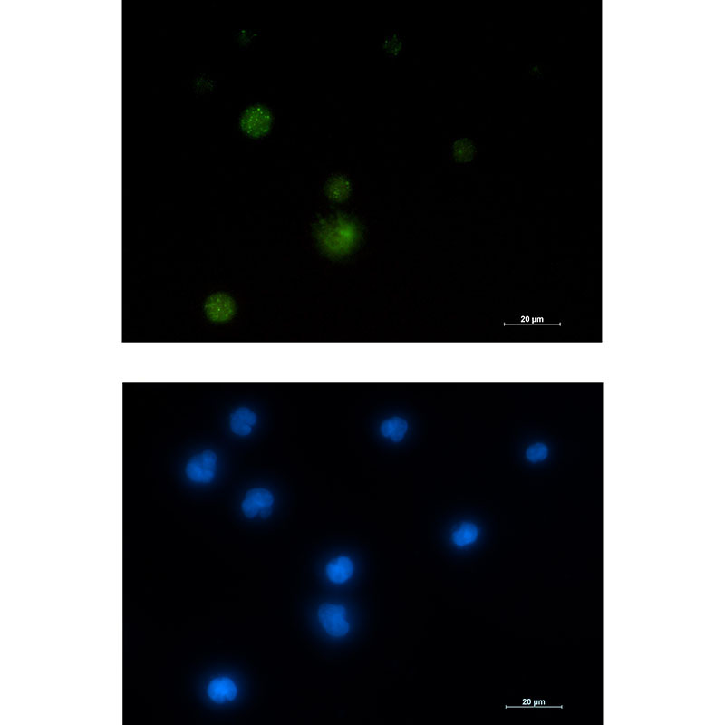 E1B AP5 Rabbit mAb
