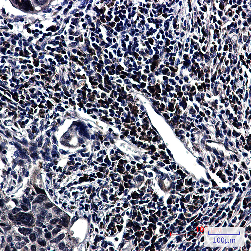 E1B AP5 Rabbit mAb