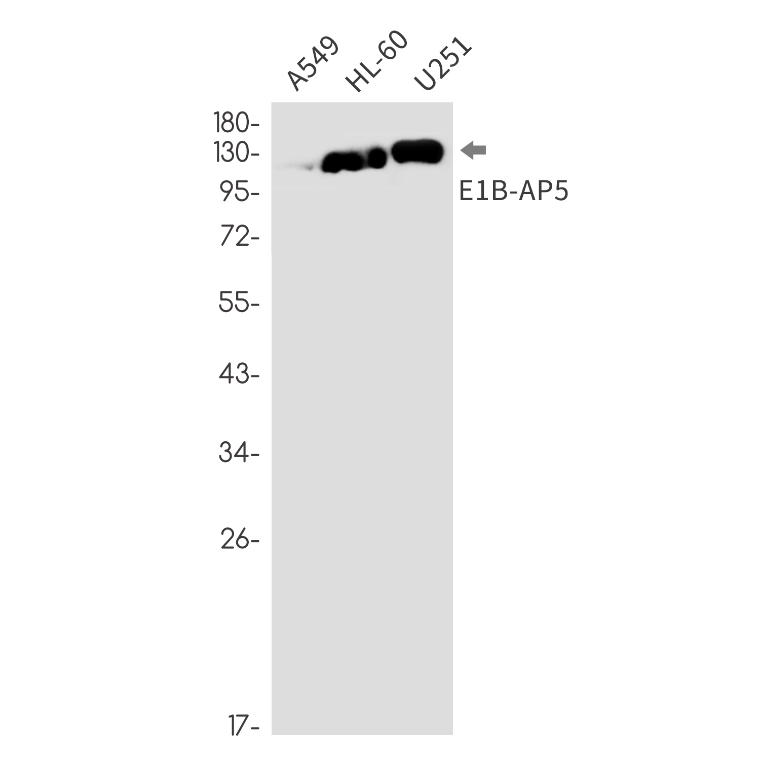E1B AP5 Rabbit mAb