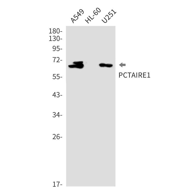 CDK16 Rabbit mAb