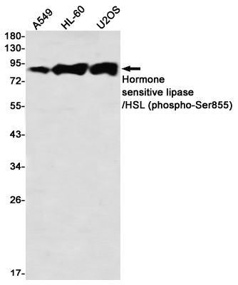 Phospho-Hormone Sensitive Lipase (Ser855) Rabbit mAb