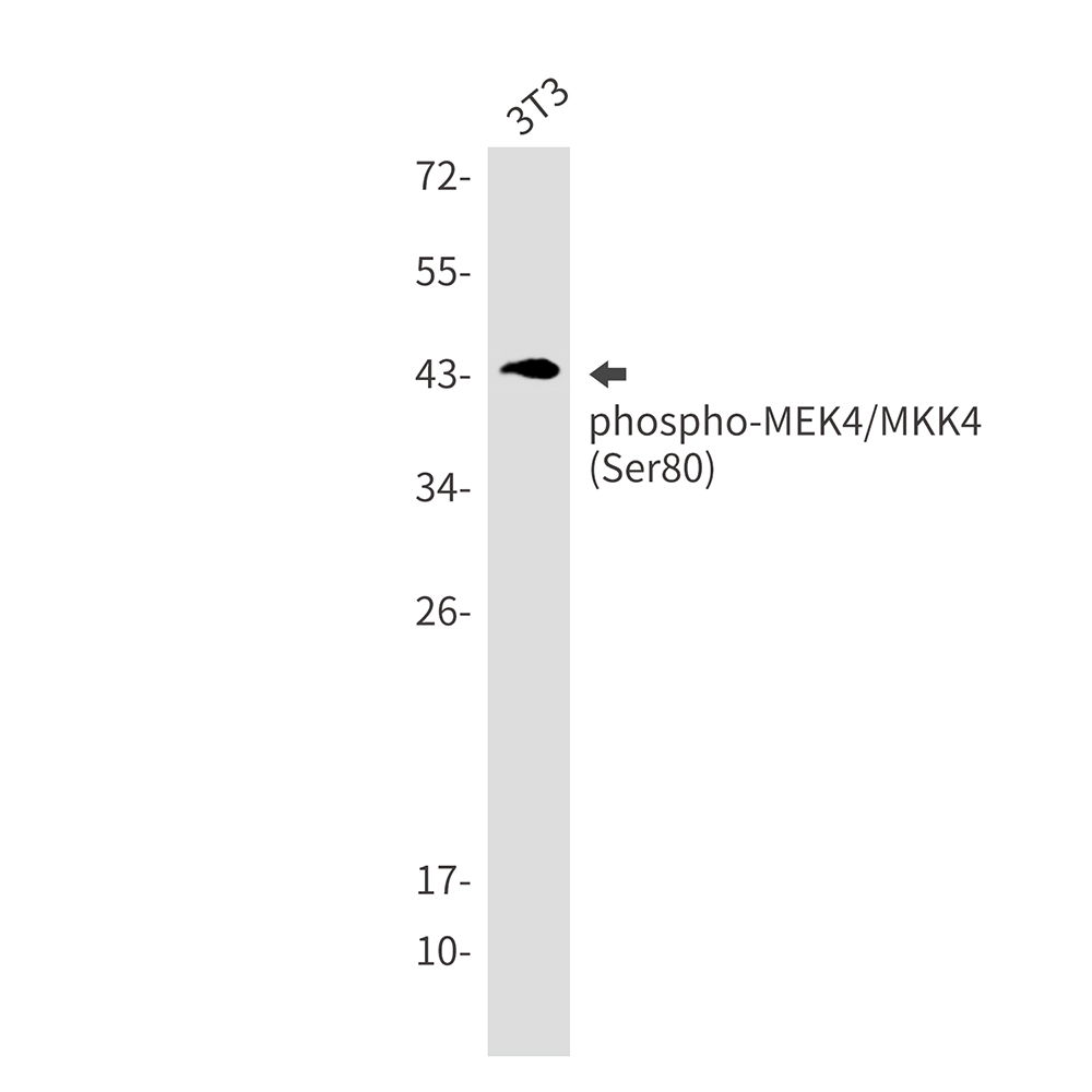 Phospho-MEK4 (Ser80) Rabbit mAb