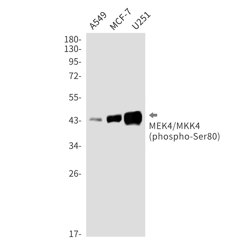 Phospho-MEK4 (Ser80) Rabbit mAb