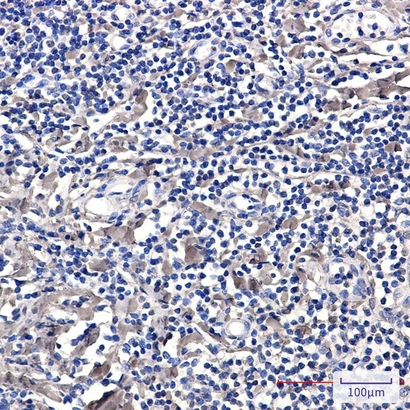 Phospho-PKC delta (Ser299) Rabbit mAb