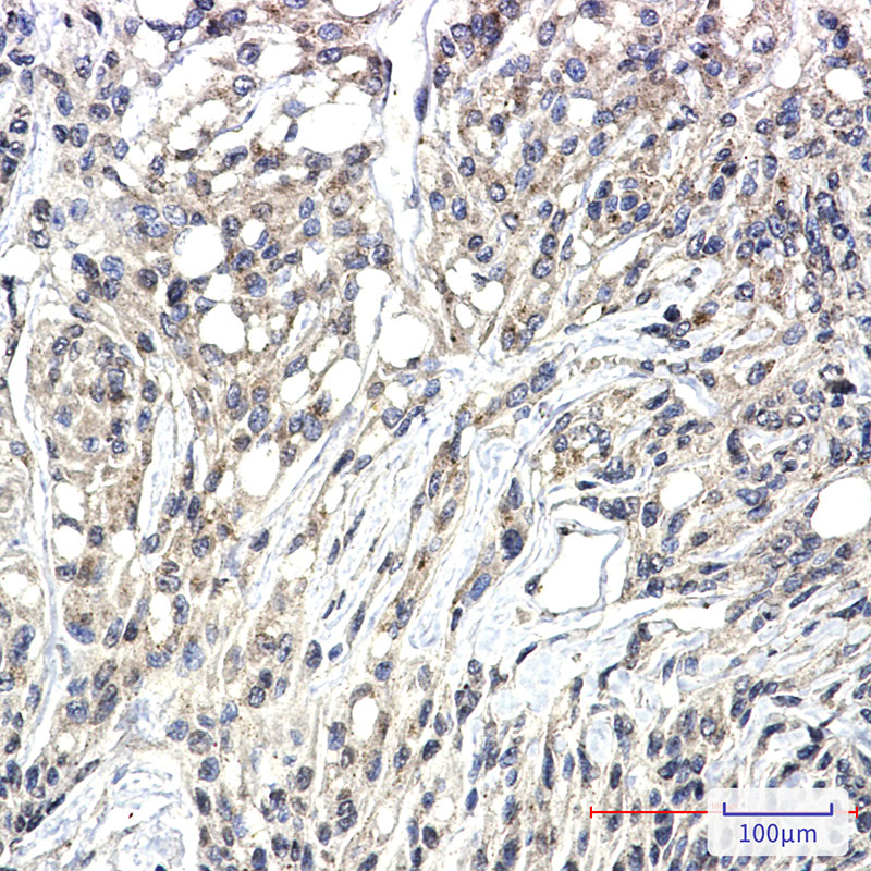 Phospho-PKC zeta/lambda (Thr410/Thr412) Rabbit mAb