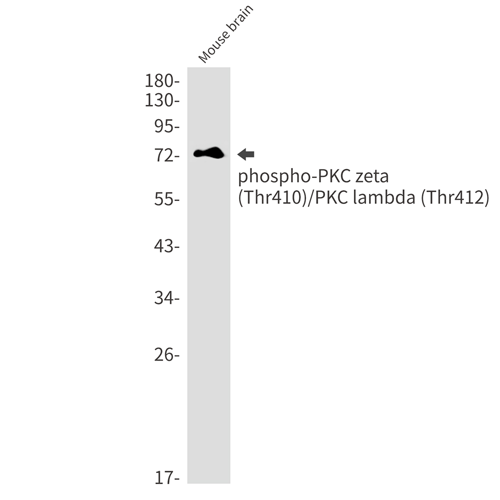 Phospho-PKC zeta/lambda (Thr410/Thr412) Rabbit mAb