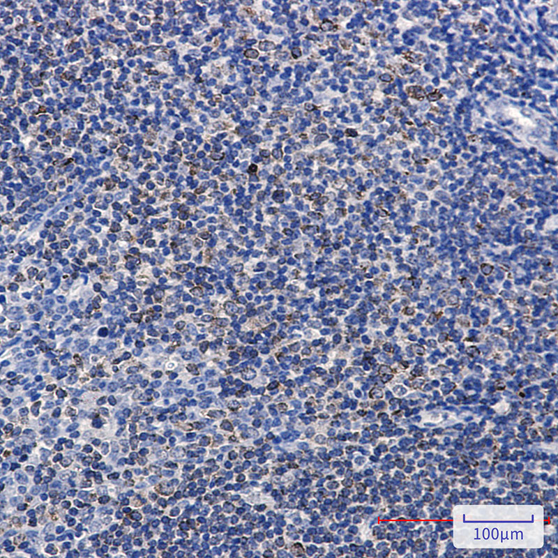 Phospho-PTP1B (Ser378) Rabbit mAb