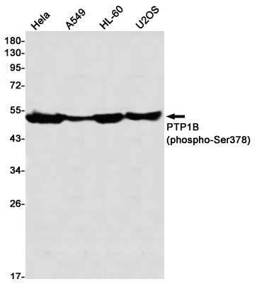 Phospho-PTP1B (Ser378) Rabbit mAb
