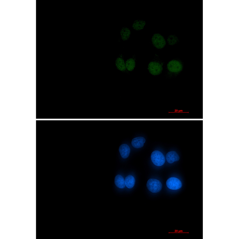 Phospho-Rad17 (Ser656) Rabbit mAb