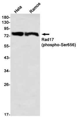 Phospho-Rad17 (Ser656) Rabbit mAb