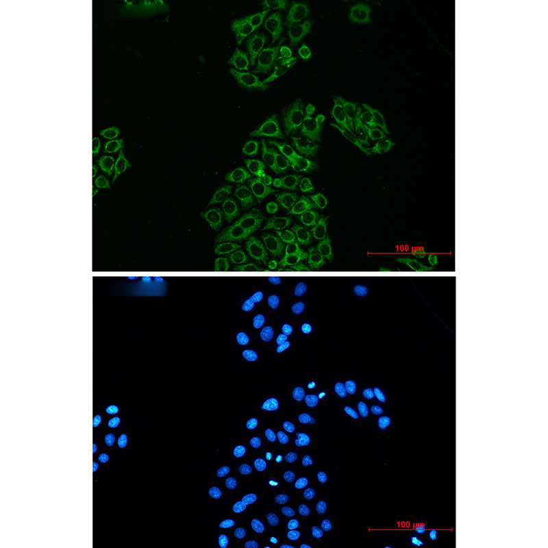 AK2 Rabbit mAb