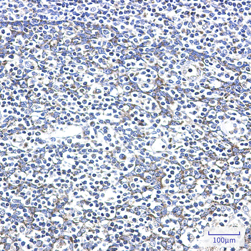 AK2 Rabbit mAb