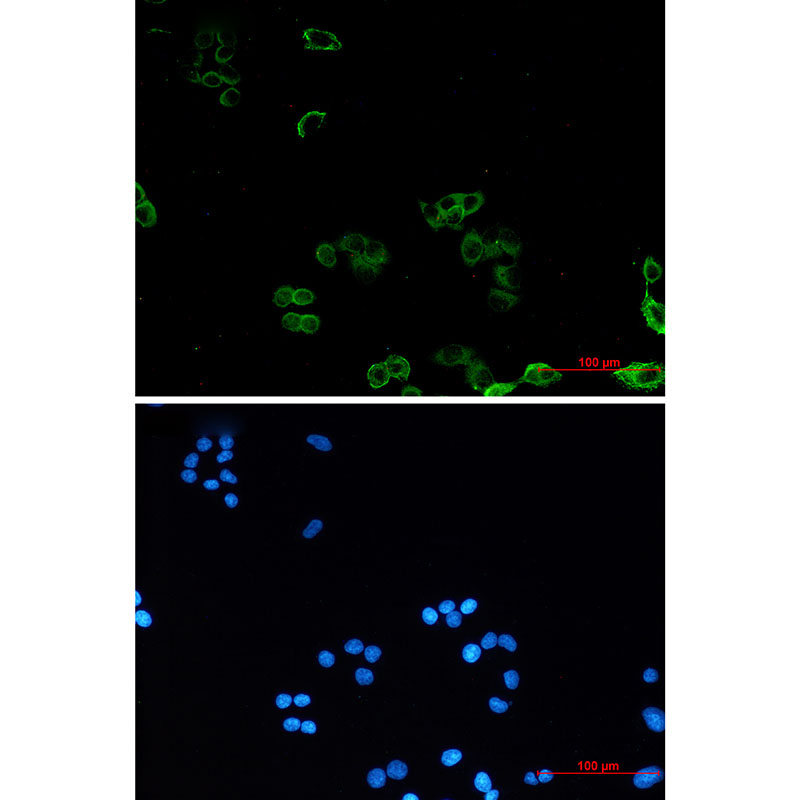 AMPK gamma 1 Rabbit mAb