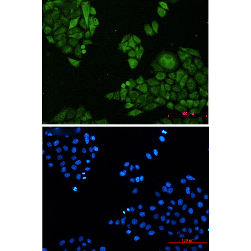 Annexin 4 Rabbit mAb