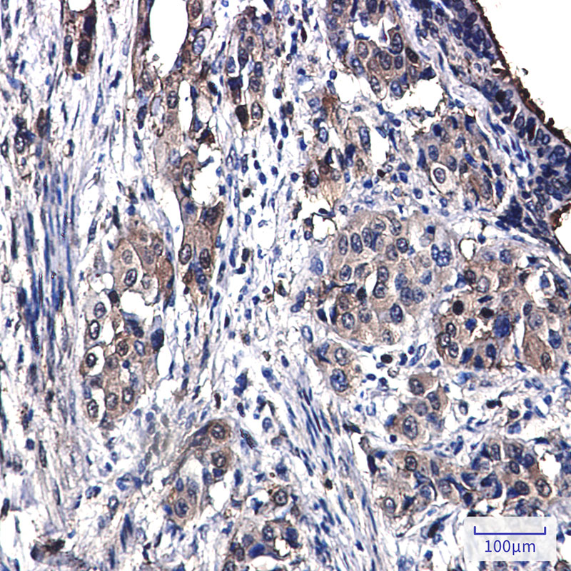 Annexin 4 Rabbit mAb