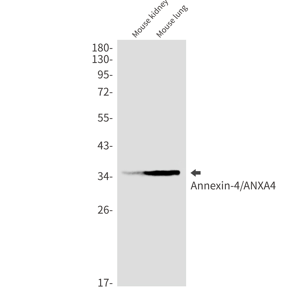 Annexin 4 Rabbit mAb