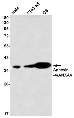 Annexin 4 Rabbit mAb