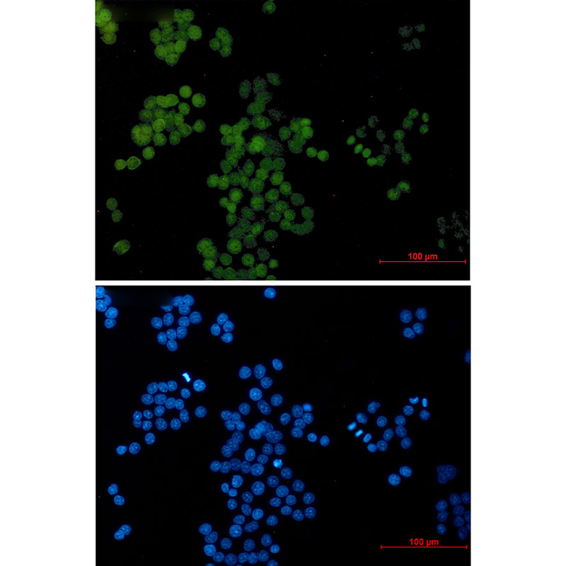 Transcription Factor AP 2 gamma Rabbit mAb