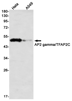 Transcription Factor AP 2 gamma Rabbit mAb
