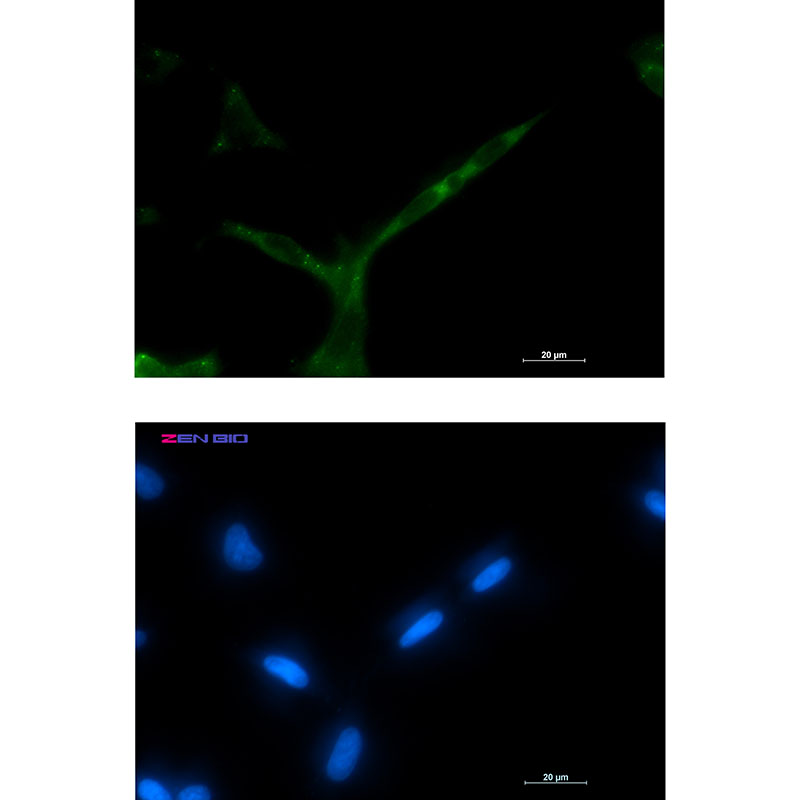 APC Rabbit mAb
