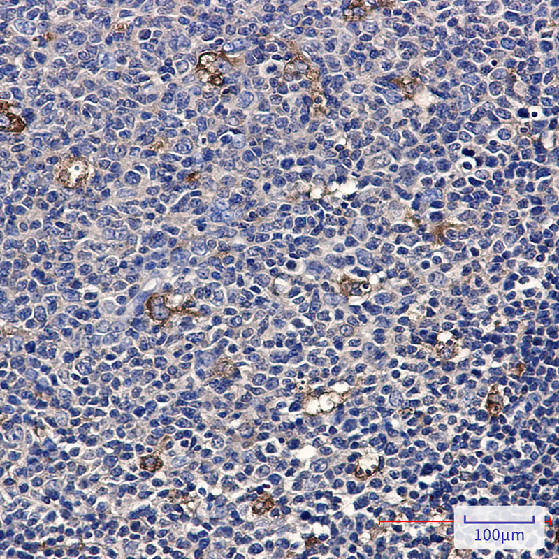 ATP6V1A Rabbit mAb