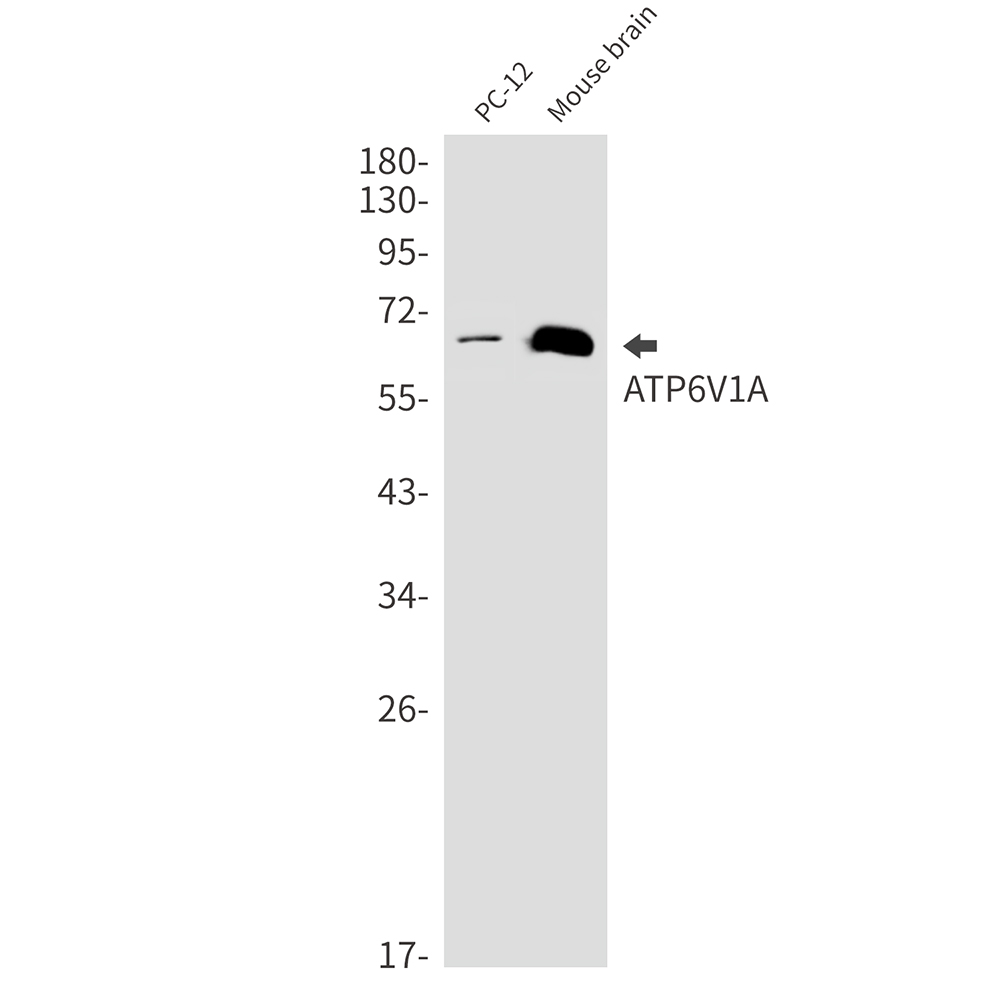 ATP6V1A Rabbit mAb