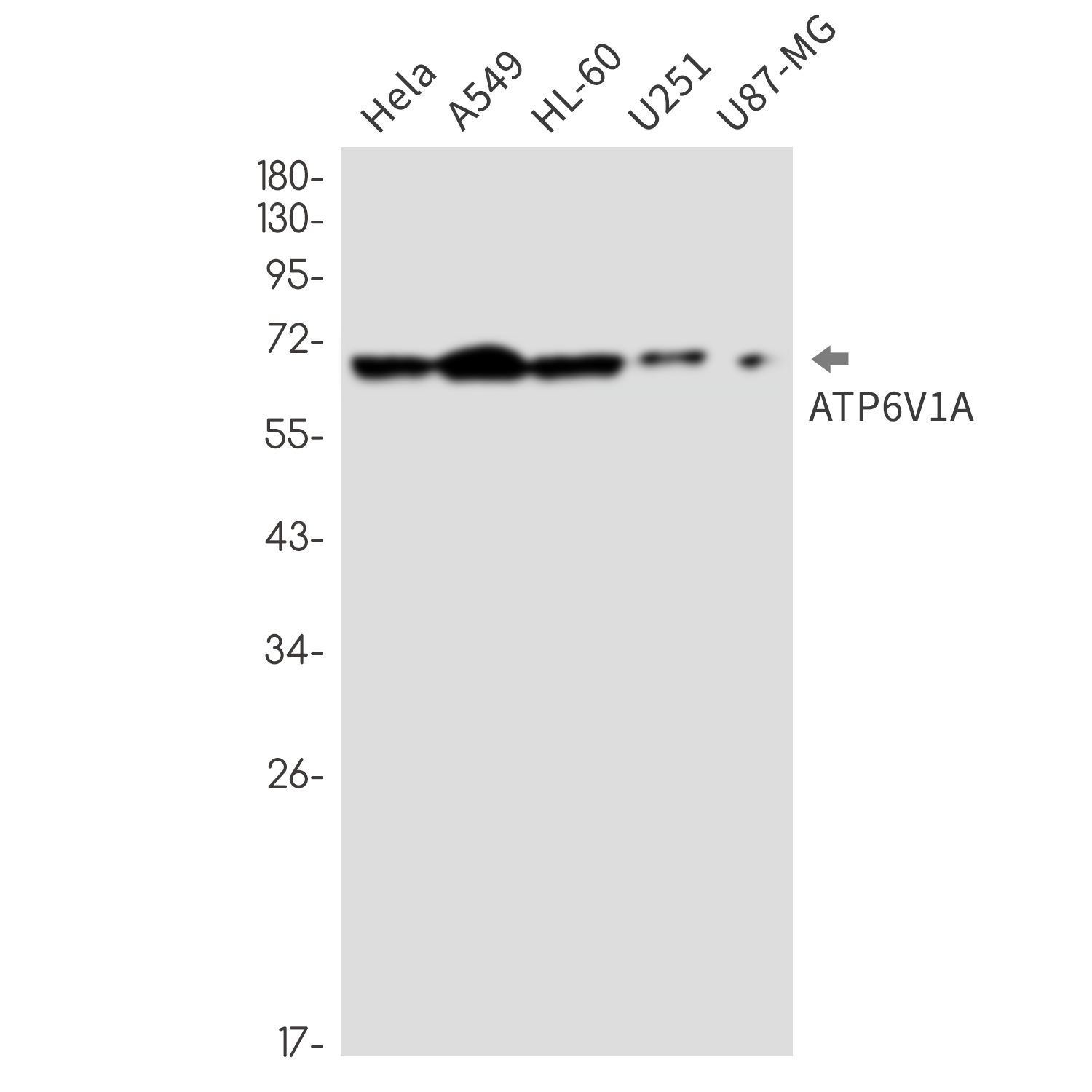 ATP6V1A Rabbit mAb