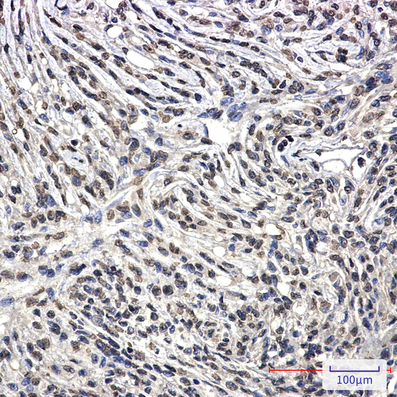 Bcr Rabbit mAb