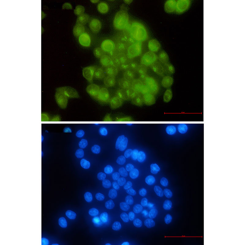 BUBR1 Rabbit mAb