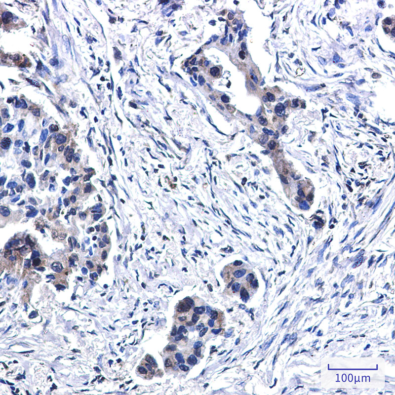 BUBR1 Rabbit mAb