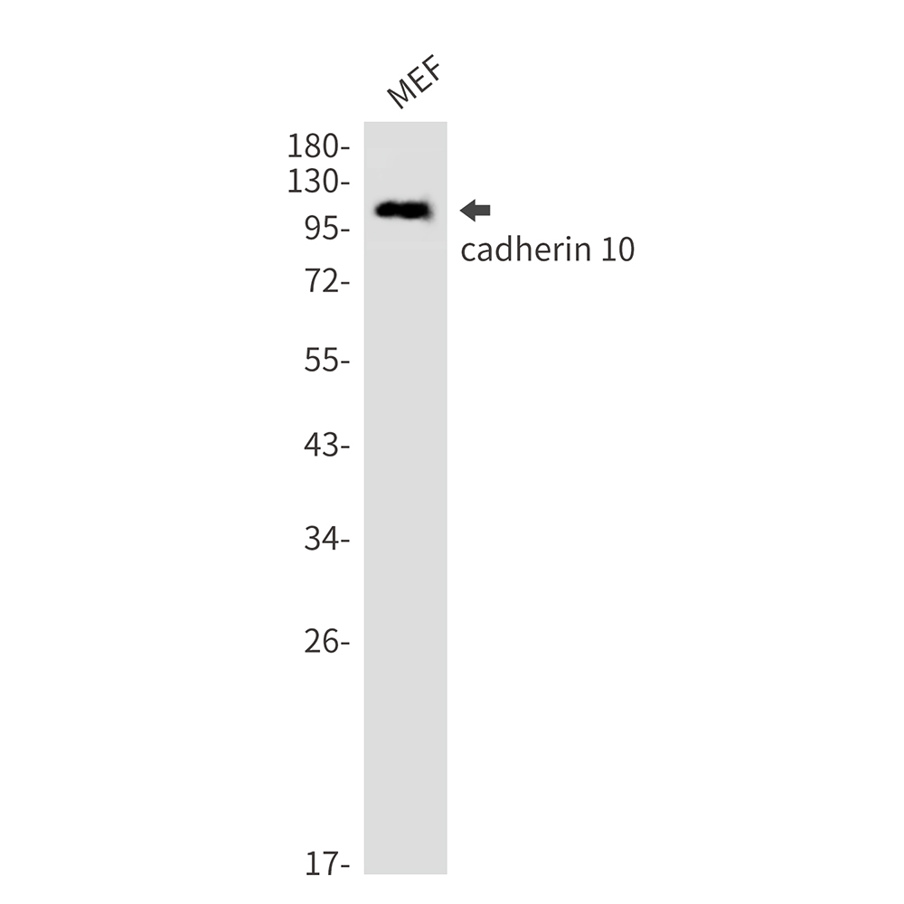 Cadherin 10 Rabbit mAb