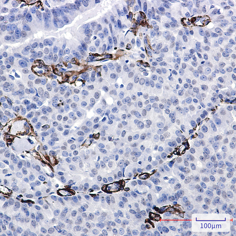Caldesmon Rabbit mAb