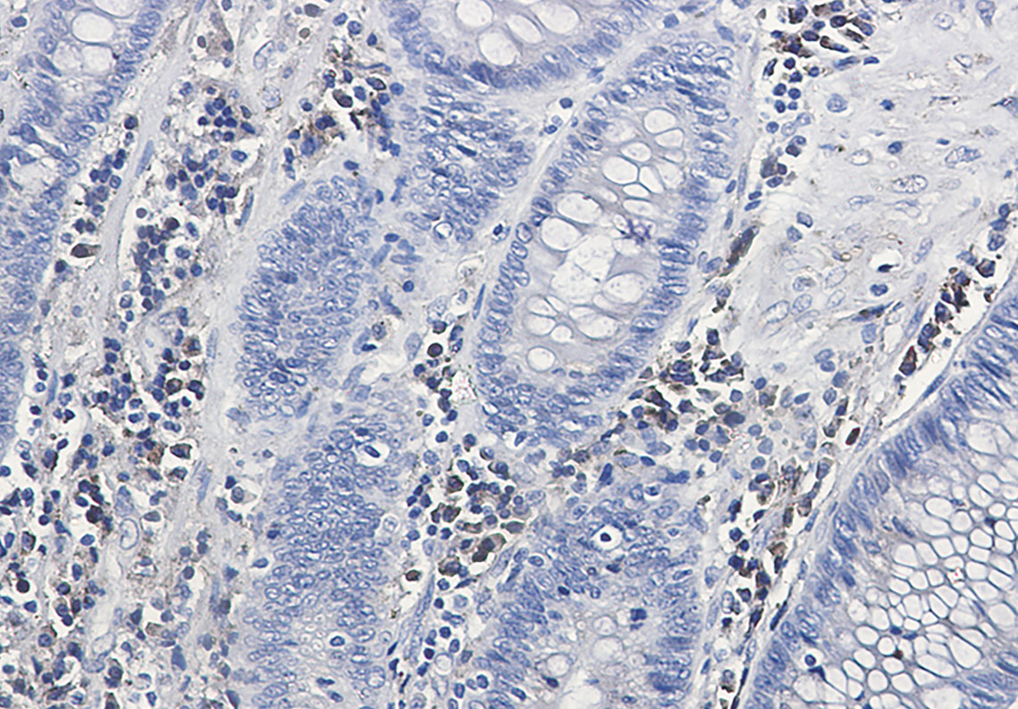 Calumenin Rabbit mAb