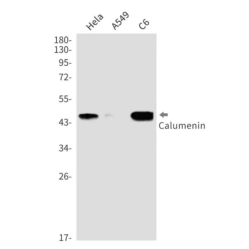 Calumenin Rabbit mAb