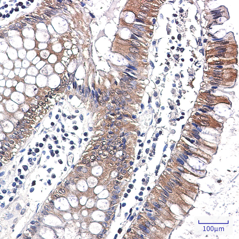Caspase 7 Rabbit mAb