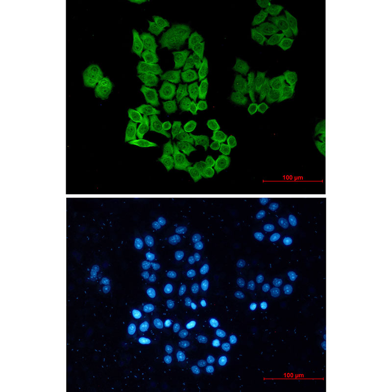 CCT2 Rabbit mAb