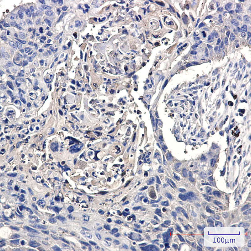 CCT2 Rabbit mAb
