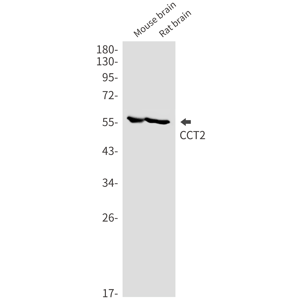 CCT2 Rabbit mAb
