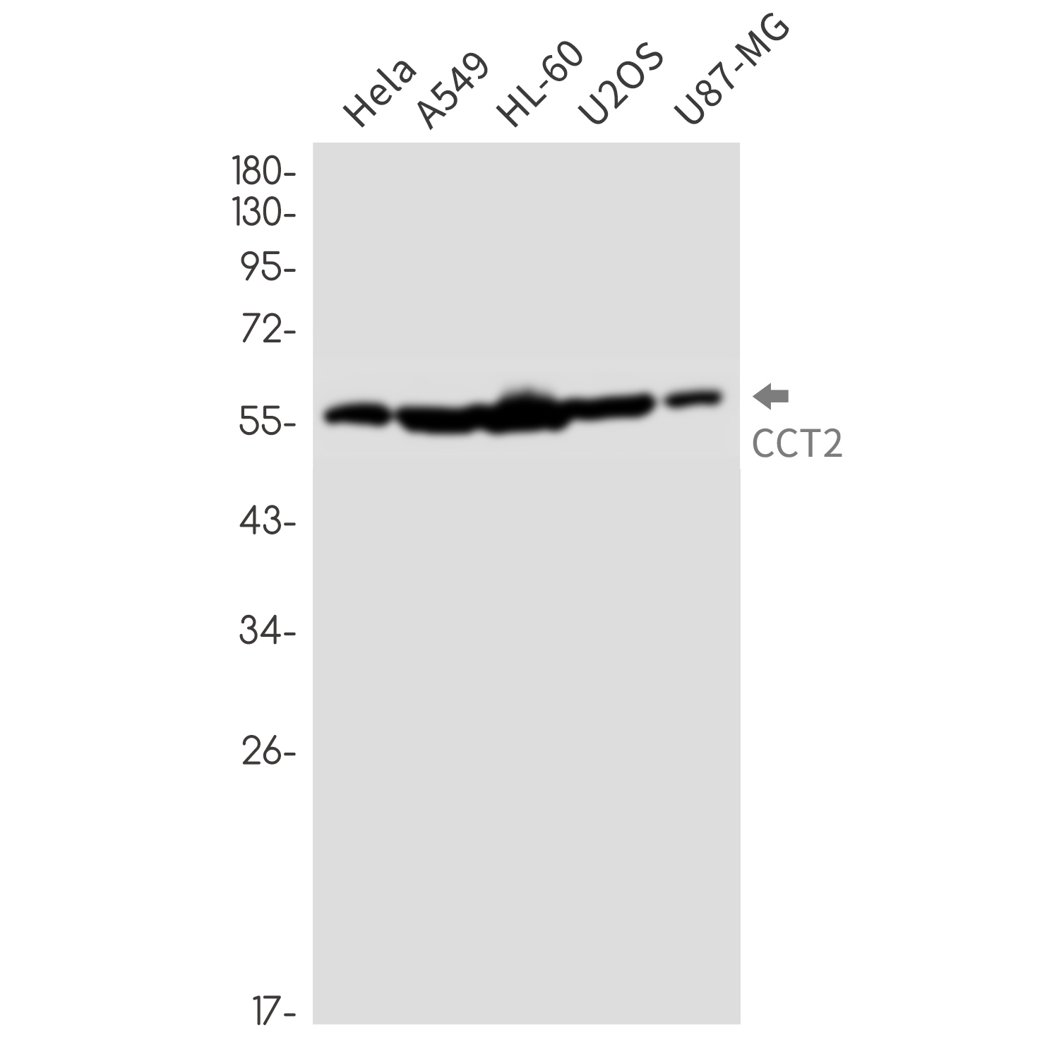 CCT2 Rabbit mAb