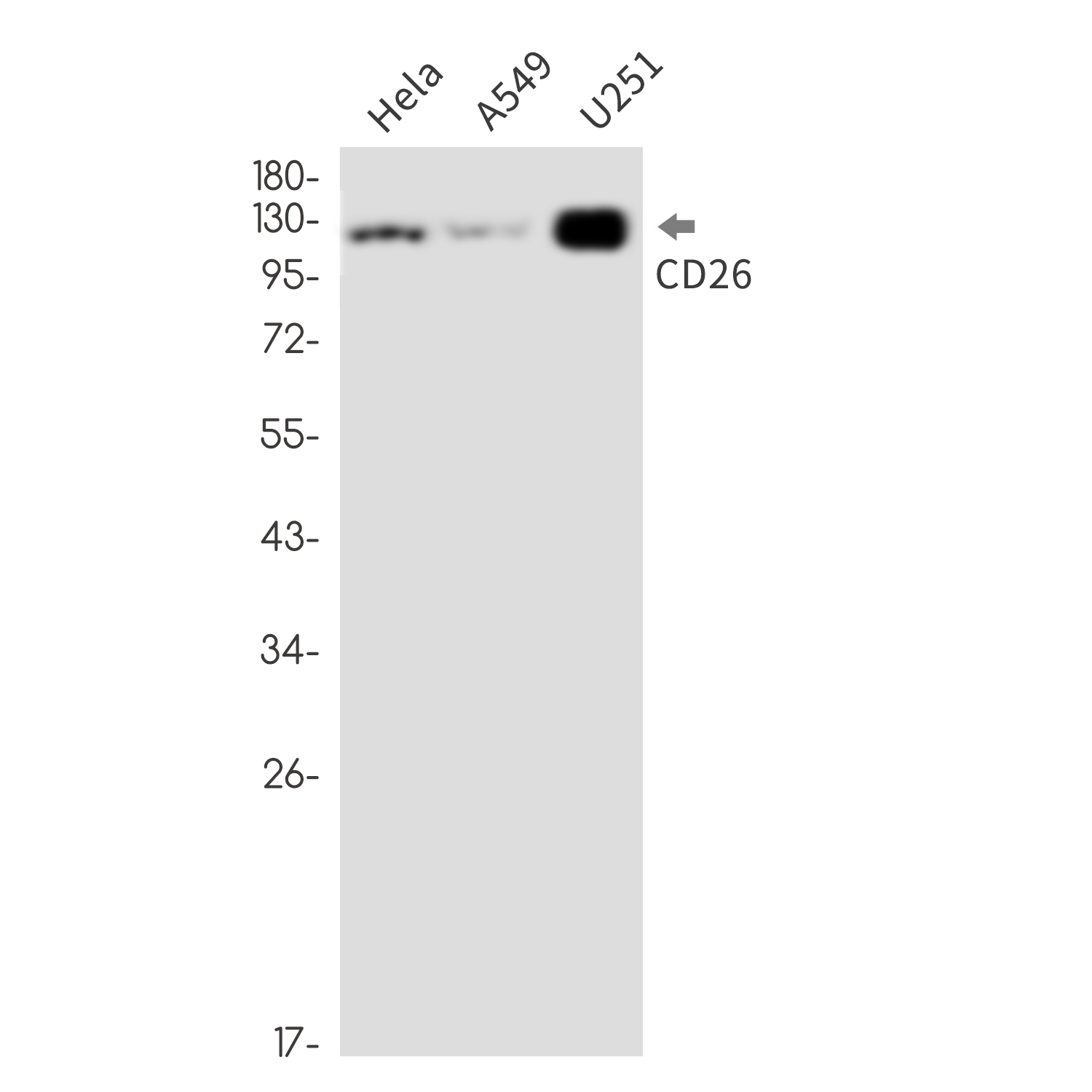 CD26 Rabbit mAb