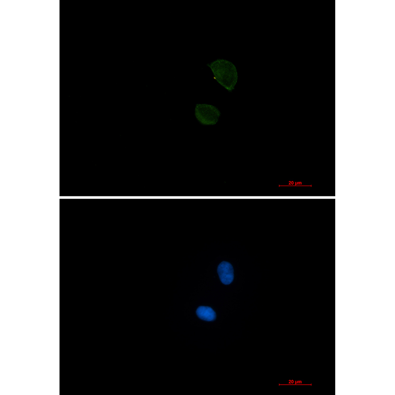 CD99 Rabbit mAb