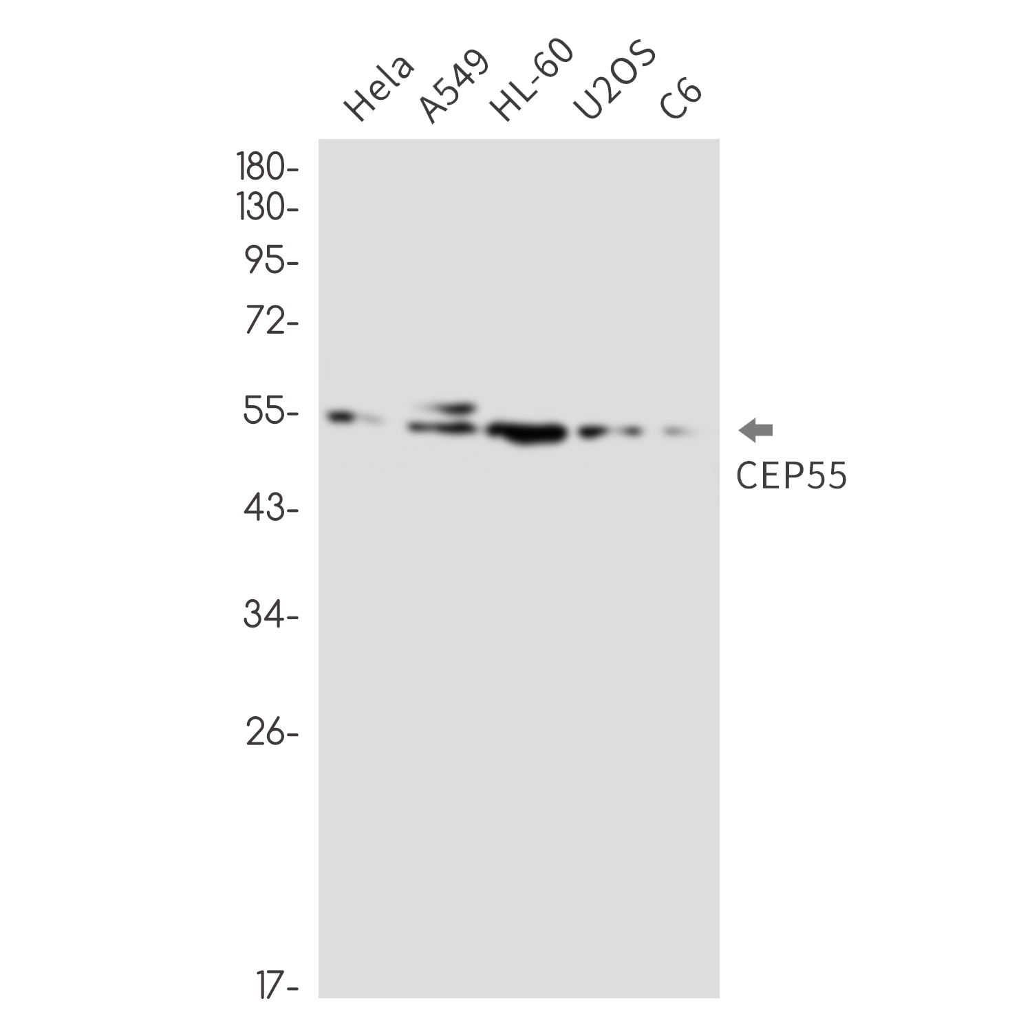 CEP55 Rabbit mAb