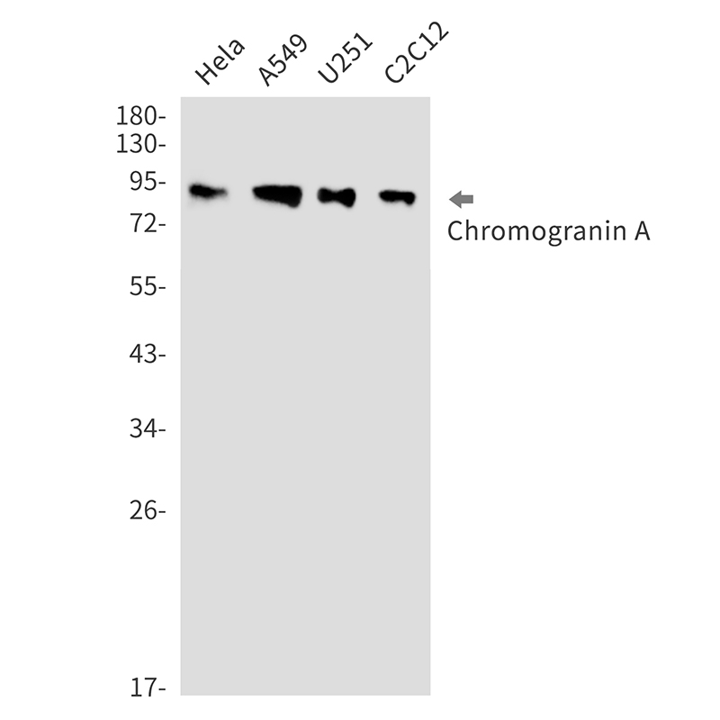 Chromogranin A Rabbit mAb