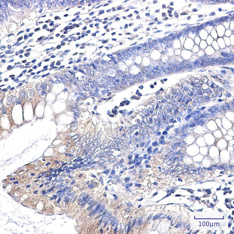 Clathrin Heavy Chain Rabbit mAb