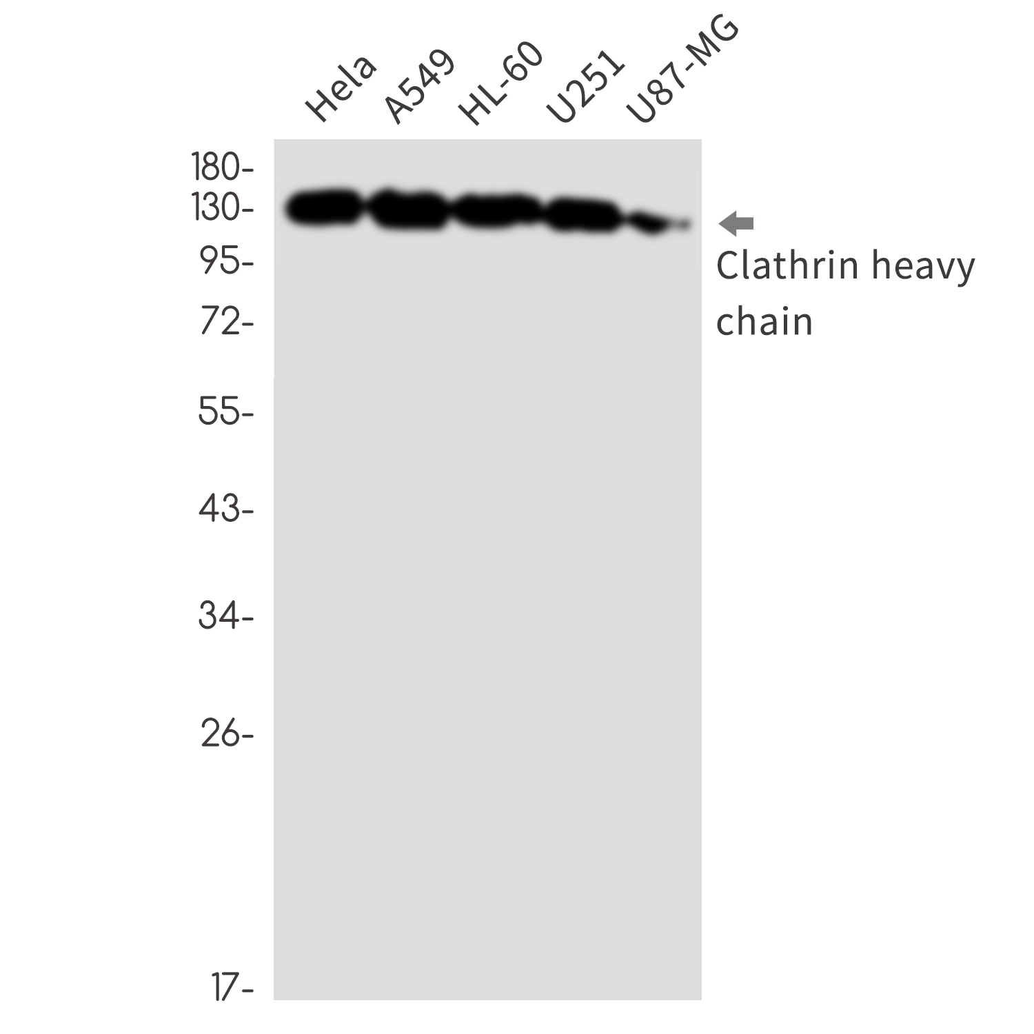 Clathrin Heavy Chain Rabbit mAb